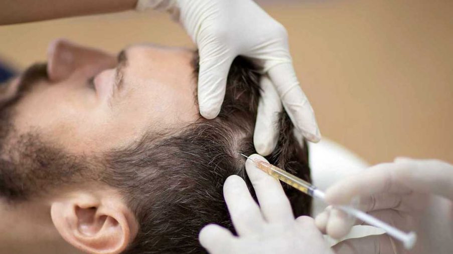 مزوتراپی مو در شاهین‌ شهر